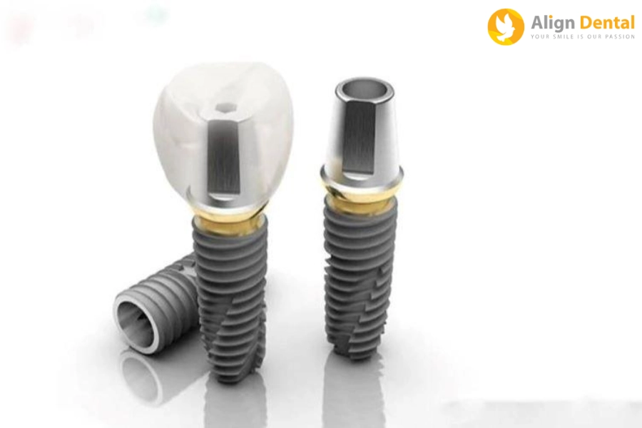 Top 5+ Các Loại Trụ Implant Hàn Quốc Thịnh Hành Tại Việt Nam