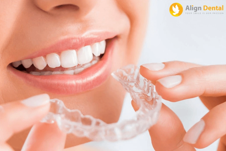 Quy Trình Niềng Răng Invisalign Đạt Chuẩn Khoa Học