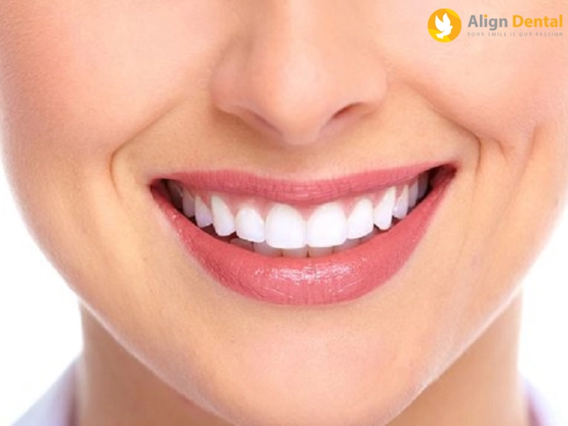 nha khoa align dental là lựa chọn uy tín của nhiều khách hàng