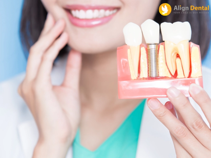 Giải pháp khắc phục tình trạng hôi miệng sau khi trồng răng Implant?
