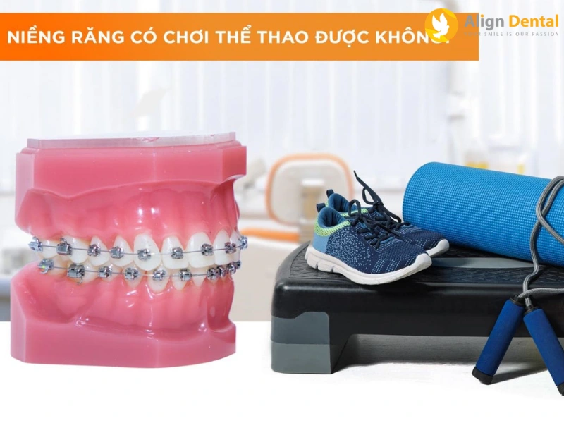 niềng răng có chơi thể thao được không