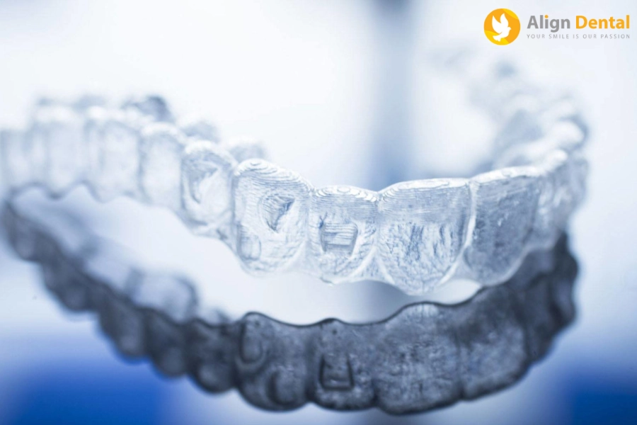 Niềng Răng Invisalign Mất Bao Lâu? Cách Làm Giảm Thời Gian Niềng