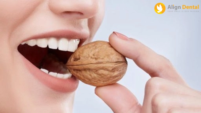 trồng răng implant kiêng ăn gì